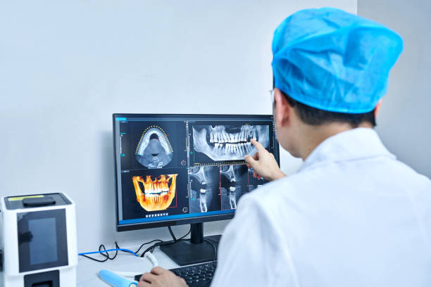 Best Urgent Care for Lost Fillings or Crowns in Live Oak, CA